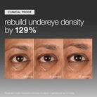 DermalogicaDermalogica Smart Eye Density SerumSkinShop