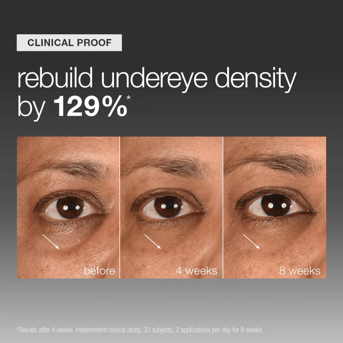 DermalogicaDermalogica Smart Eye Density SerumSkinShop