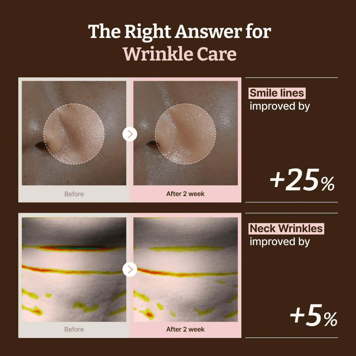 Dr.Reju-AllDr.Reju-All Advanced PDRN Rejuvenating Mask (4ea)SkinShop