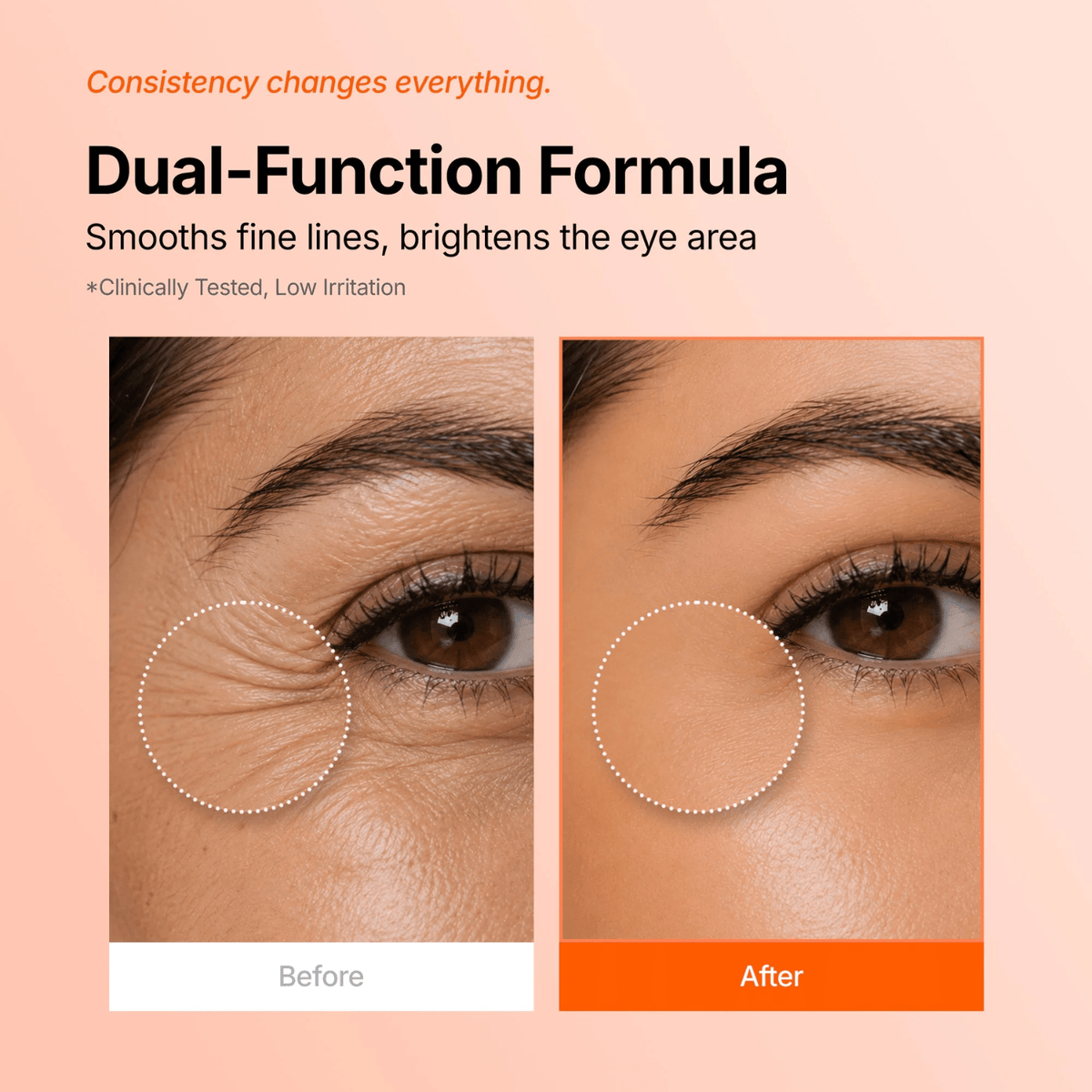Genabelle PDRN 360 Rejuvenating Eye Mask (70ea) SkinShop