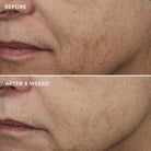 Image SkincareImage Skincare AGELESS+ Retinol Overnight Masque 0.5% Retinol Complex 50mlSkinShop
