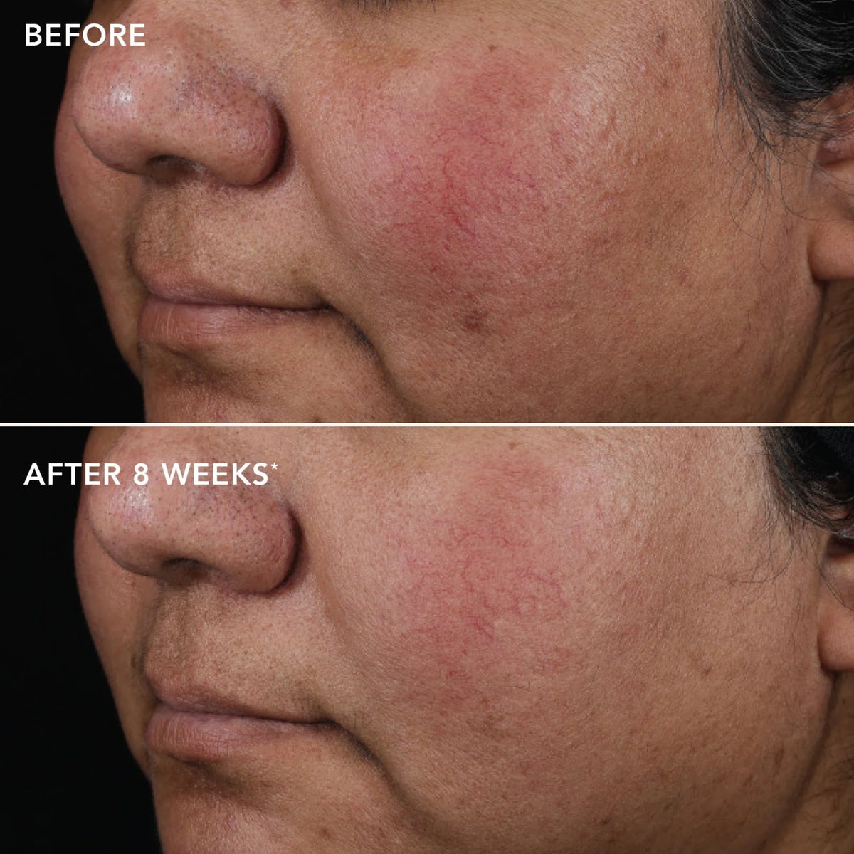 Image SkincareImage Skincare AGELESS+ Retinol Pure Liquid Retinol 0.75% 30mlSkinShop