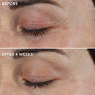 Image SkincareImage Skincare AGELESS+ Retinol Repair Cream 0.3% Retinol Complex 50mlSkinShop