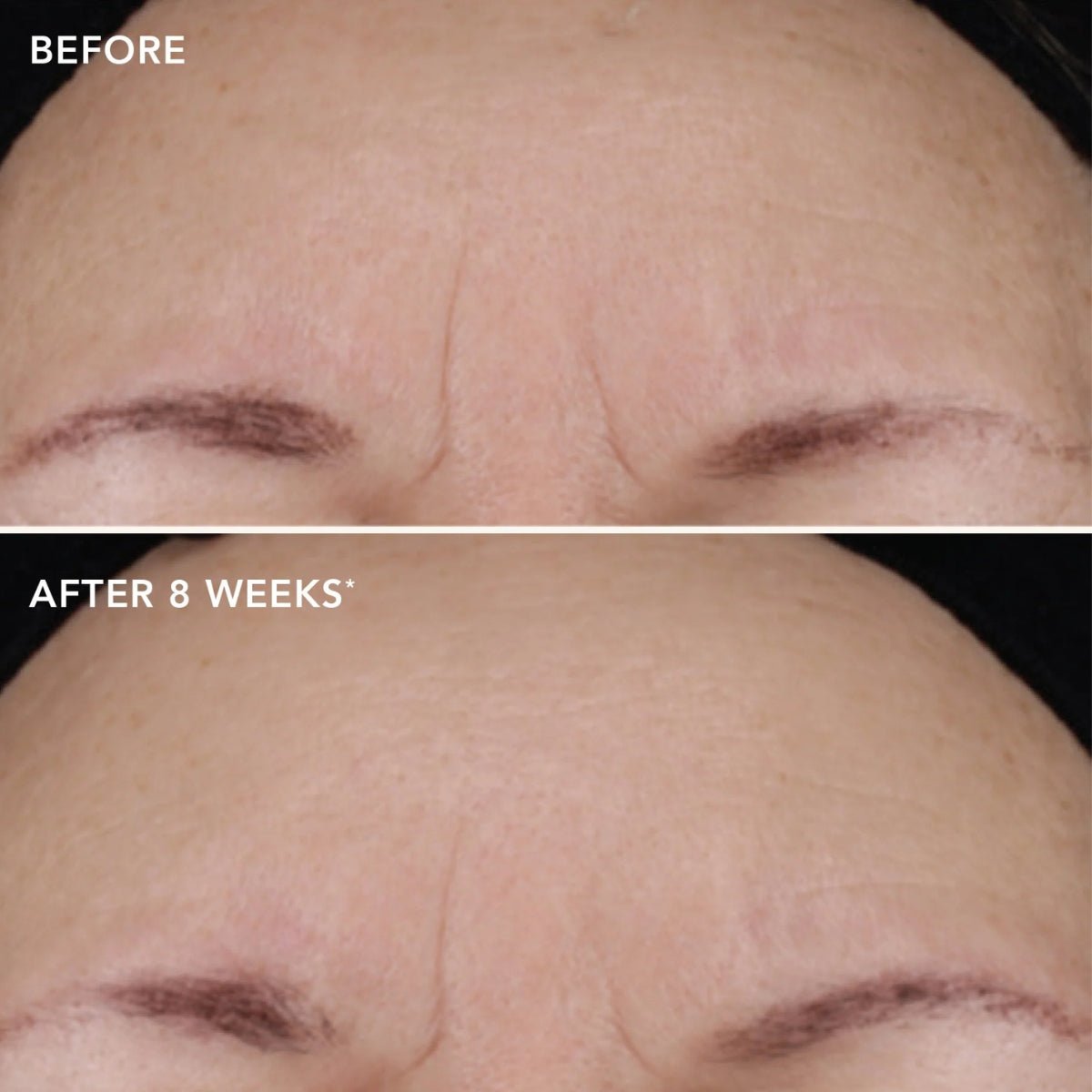 Image SkincareImage Skincare AGELESS+ Retinol Treatment Creme 1.2% Retinol Complex 28.5mlSkinShop