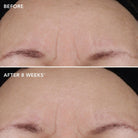 Image SkincareImage Skincare AGELESS+ Retinol Treatment Creme 1.2% Retinol Complex 28.5mlSkinShop