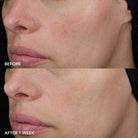 Image SkincareImage Skincare MD Barrier Repair Recovery BalmSkinShop