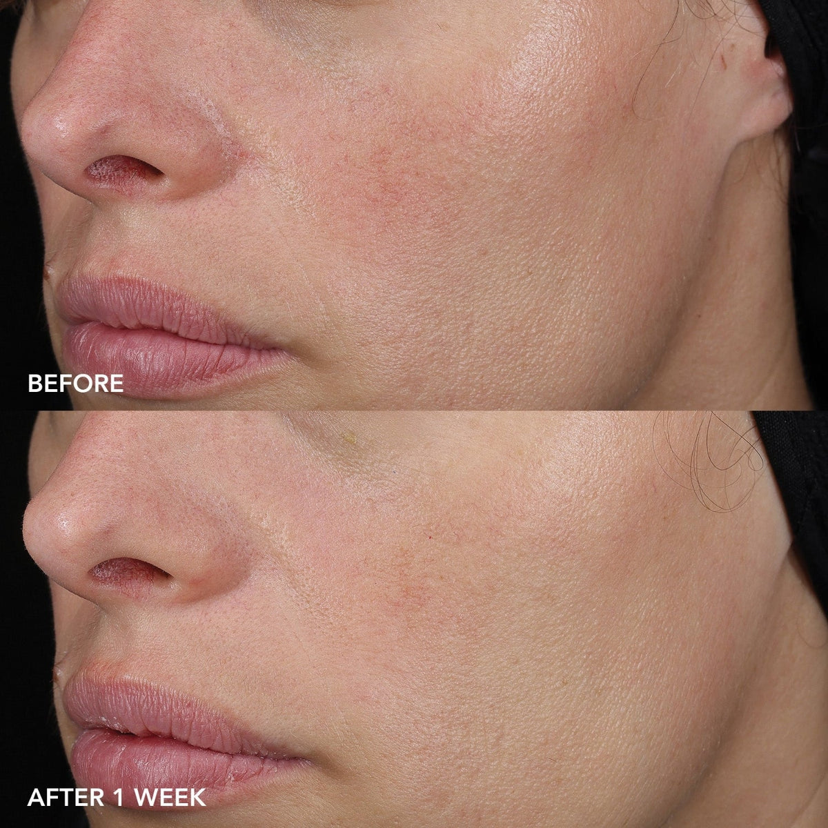 Image SkincareImage Skincare MD Barrier Repair Recovery BalmSkinShop