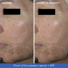 Image SkincareImage Skincare MD Restoring Power-C Serum 30mlSkinShop