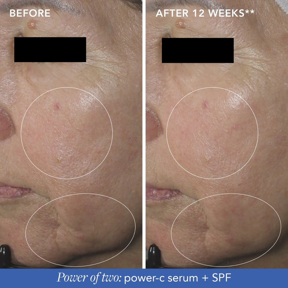 Image SkincareImage Skincare MD Restoring Power-C Serum 30mlSkinShop