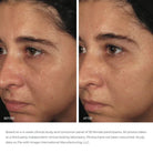 Image SkincareImage Skincare Ormedic Balancing Bio-Peptide Creme 57gSkinShop