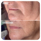 Image SkincareImage Skincare VOL.U.LIFT 4D Skin Rebound Complex 59mlSkinShop