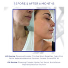 iS ClinicaliS Clinical Hydra Cool Serum 30mlSkinShop