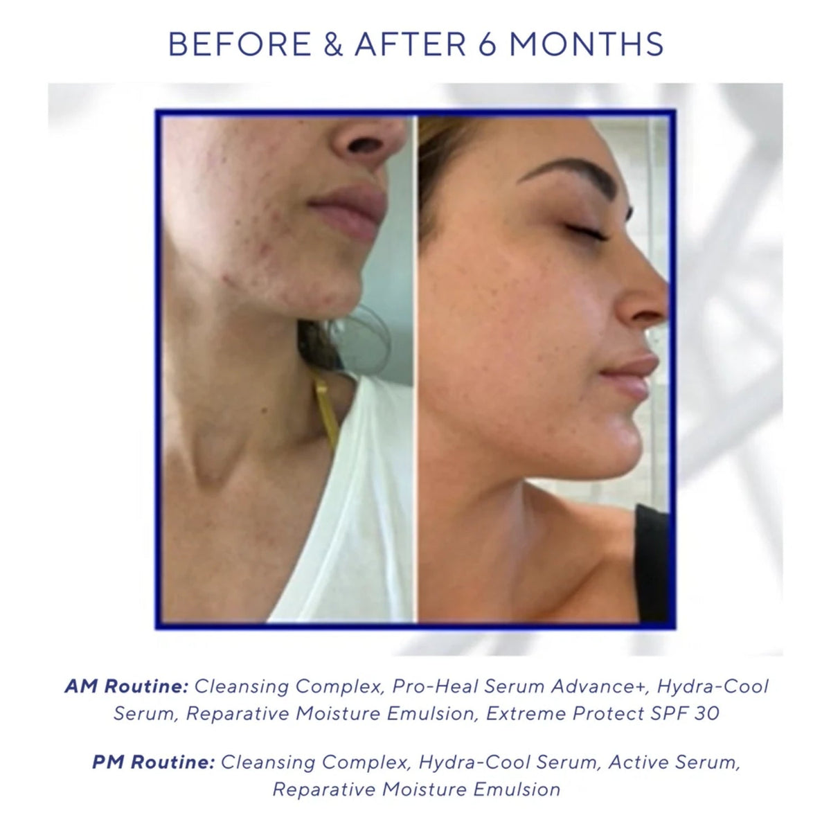 iS ClinicaliS Clinical Hydra Cool Serum 30mlSkinShop