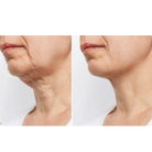 iS ClinicaliS Clinical Neck Perfect Complex 50gSkinShop
