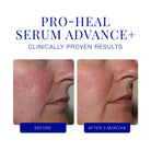iS Clinical Pro Heal Serum Advanced+ 15ml SkinShop