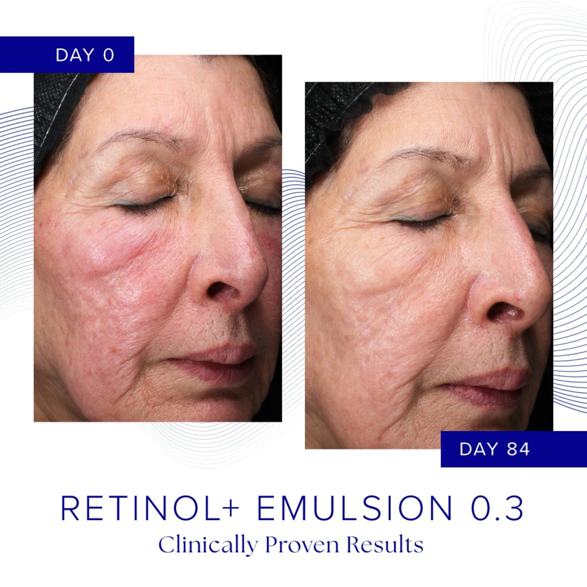 iS ClinicaliS Clinical Retinol+ Emulsion 0.3 30gSkinShop