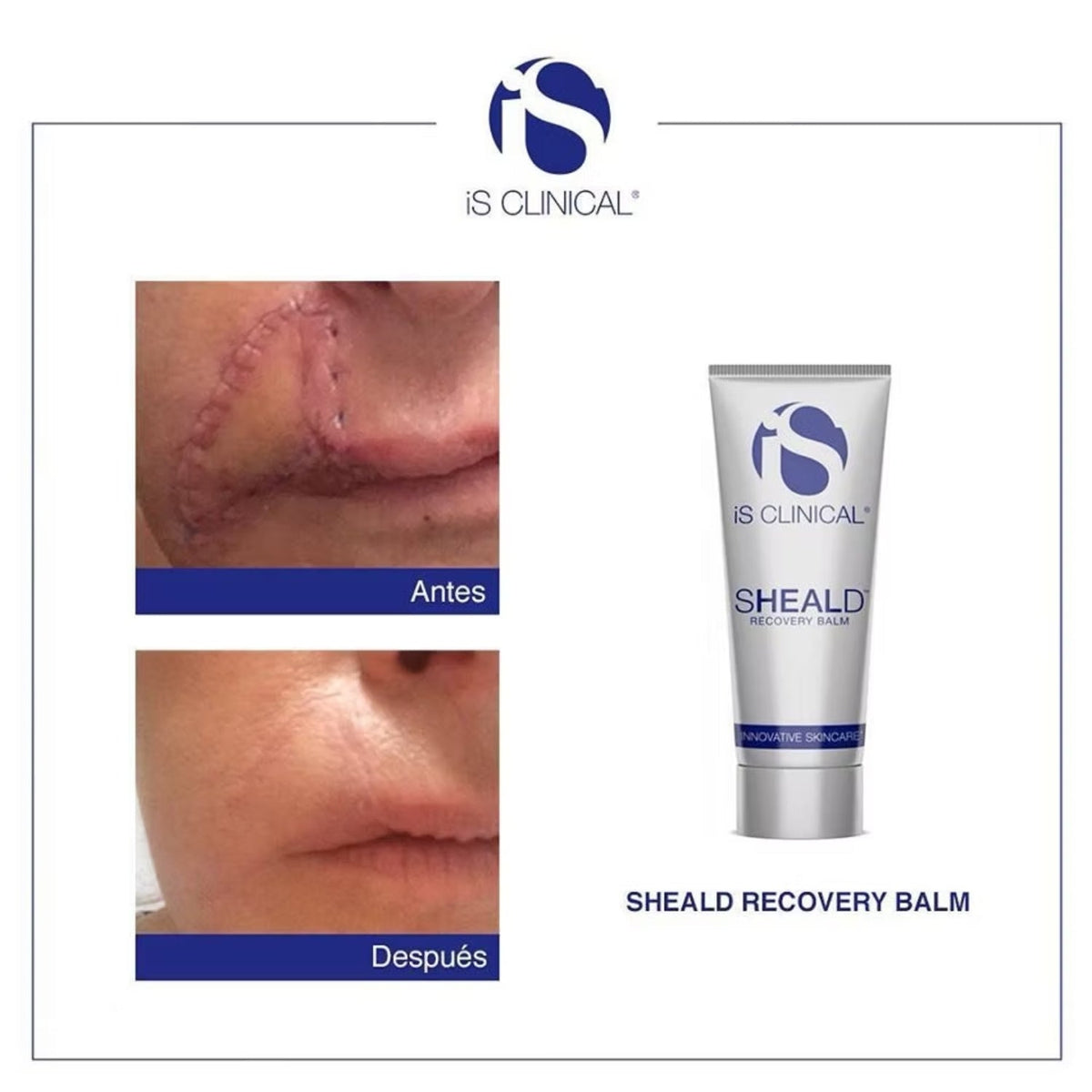 iS ClinicaliS Clinical SHEALD Recovery Balm 60gSkinShop