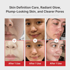 MedicubeMedicube AGE-R Booster Pro X2 PinkSkinShop