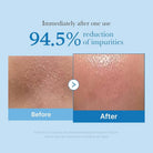 MedicubeMedicube Zero Pore Blackhead Deep Cleansing Oil 205mlSkinShop