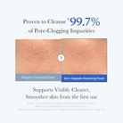 MedicubeMedicube Zero Pore Clearing Capsule Cleansing FoamSkinShop