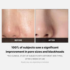 MedicubeMedicube Zero Pore Pad 2.0 70 padsSkinShop