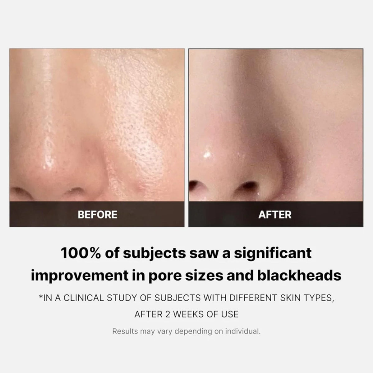 MedicubeMedicube Zero Pore Pad 2.0 70 padsSkinShop