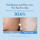 MedicubeMedicube Zero Pore Toner 250mlSkinShop