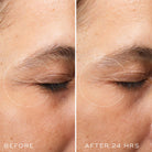 Medik8Medik8 Crystal Retinal Ceramide Eye 10 15mlSkinShop