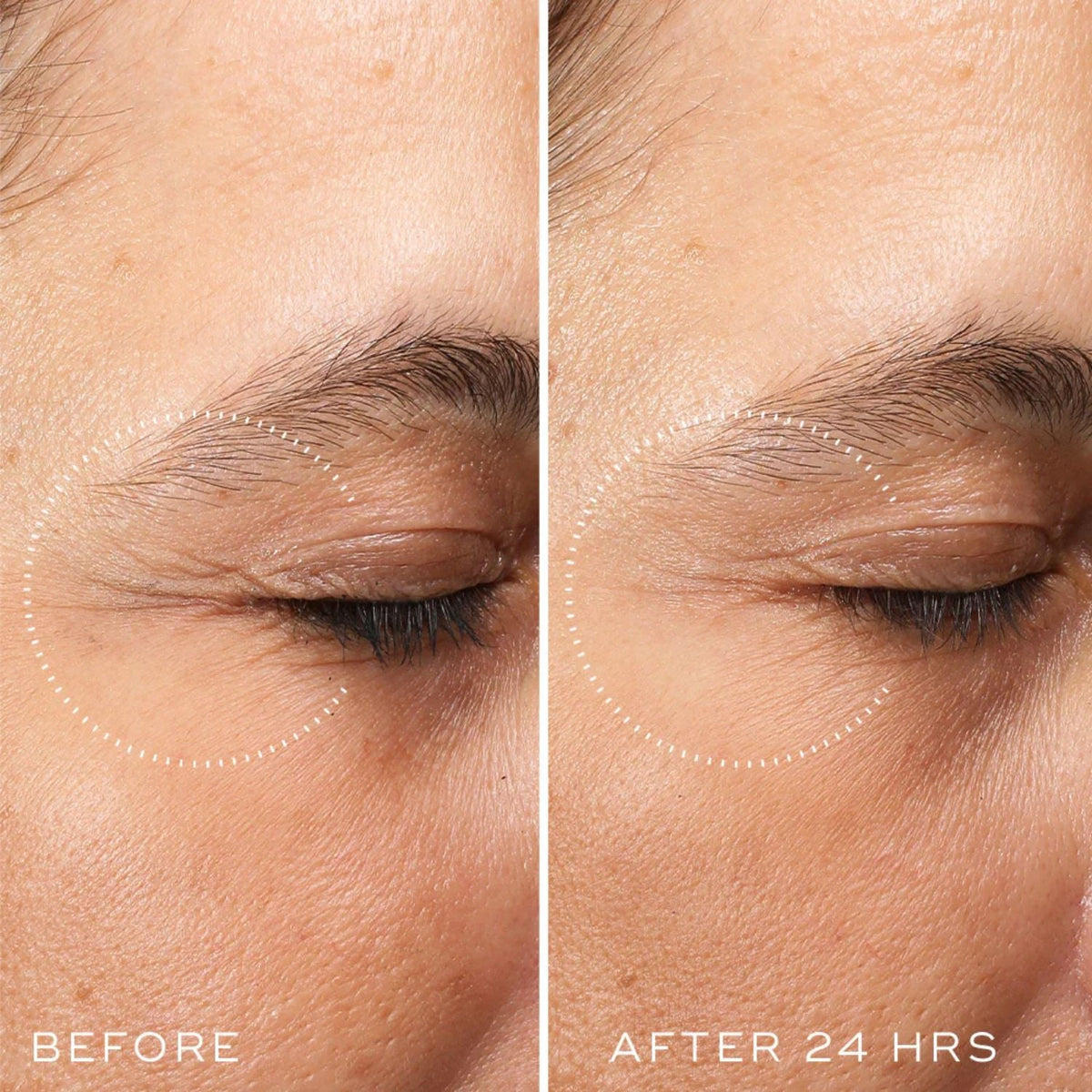 Medik8Medik8 Crystal Retinal Ceramide Eye 3 15mlSkinShop
