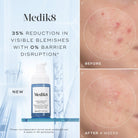 Medik8Medik8 Niacinamide Peptides 30mlSkinShop