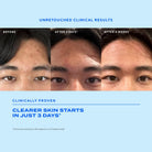MuradMurad Biome-Balancing Clear & Prevent Blemish Treatment Serum 30mlSkinShop