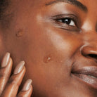 Neostrata Neostrata | Dark Spot Corrector 20g - SkinShop