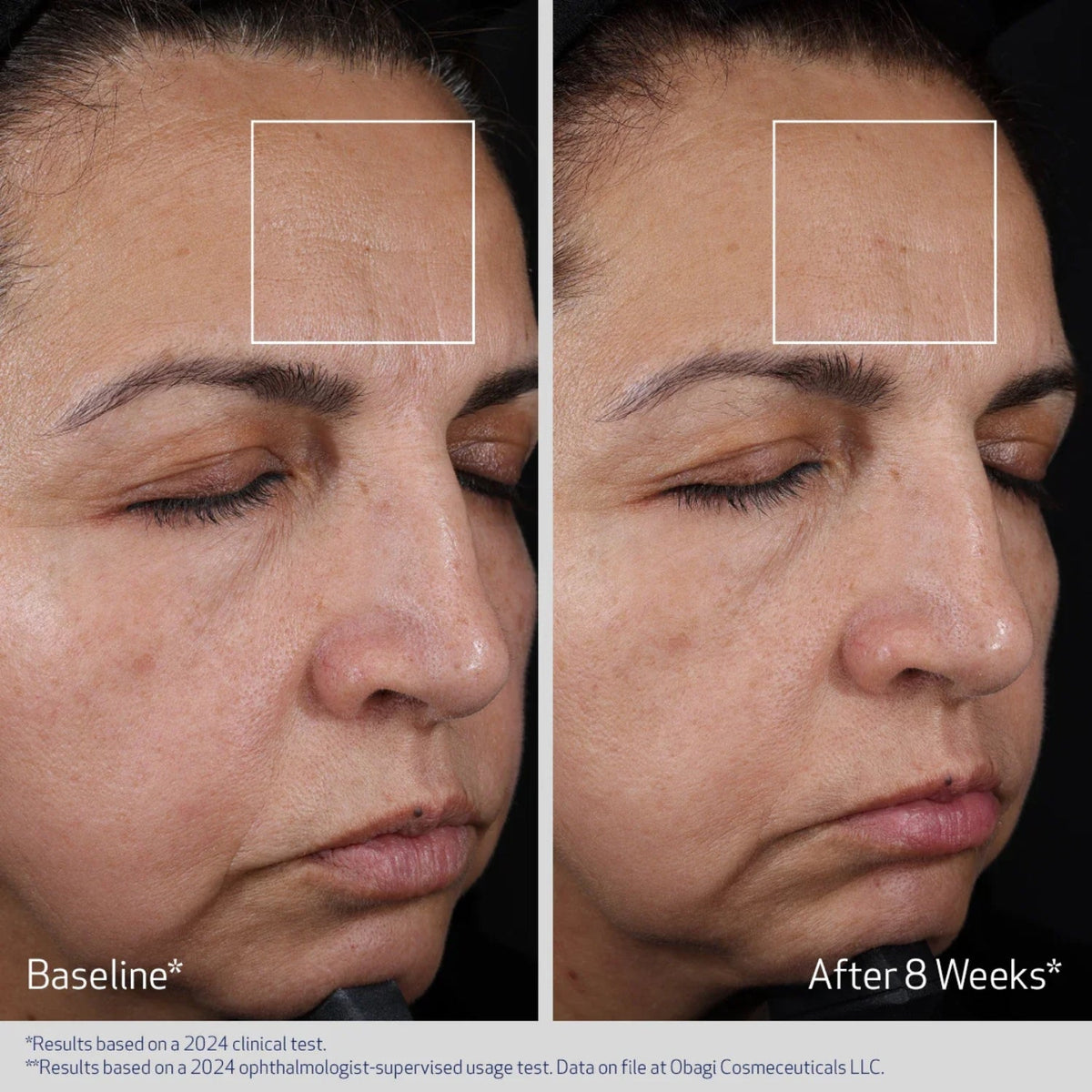 ObagiObagi ELASTIderm Advanced Filler Concentrate 20mlSkinShop