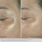 ObagiObagi ELASTIderm Eye Cream 15gSkinShop