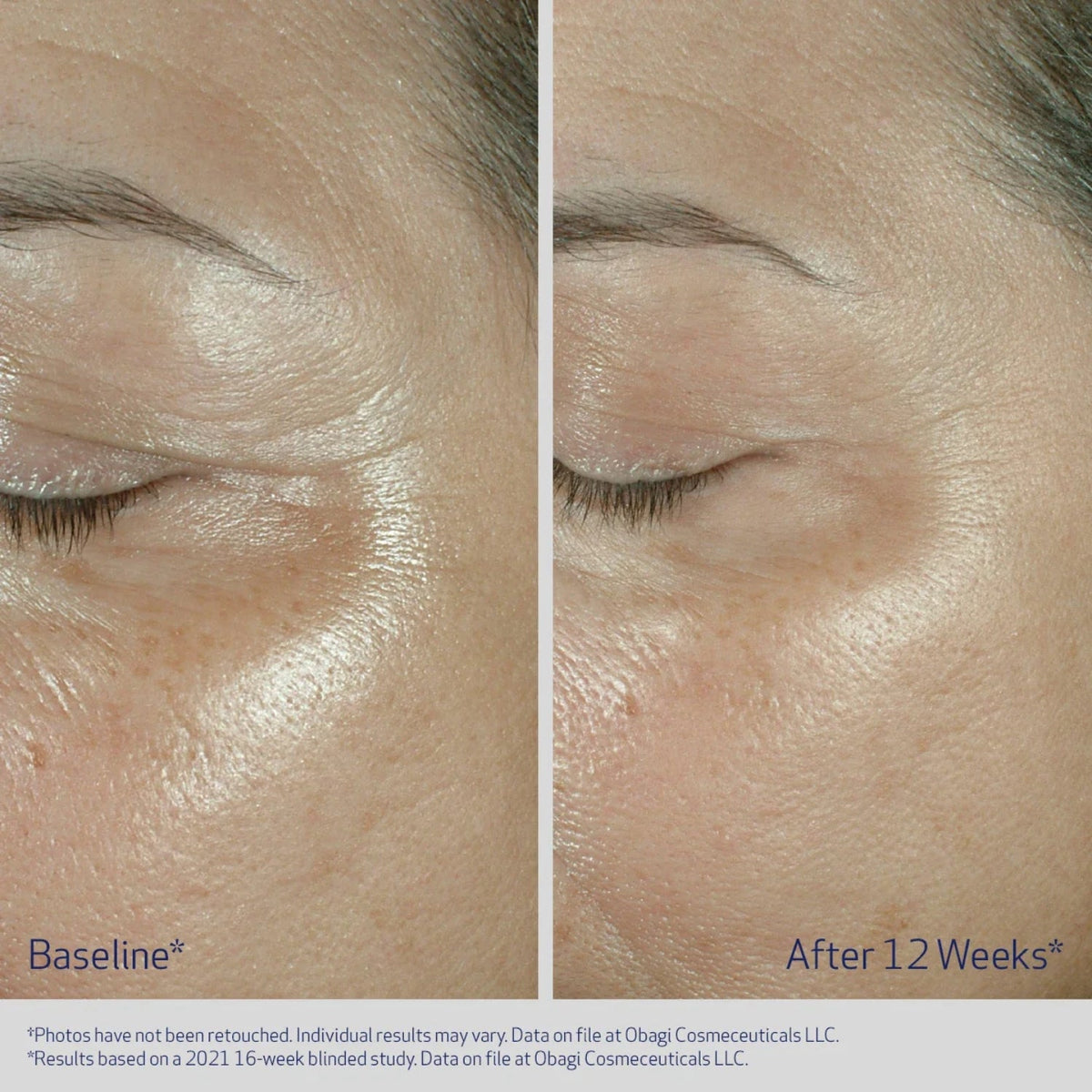 ObagiObagi ELASTIderm Eye Cream 15gSkinShop