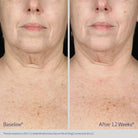 ObagiObagi ELASTIderm Neck and Decollete Concentrate 60mlSkinShop