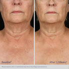 ObagiObagi ELASTIderm Neck and Decollete Concentrate 60mlSkinShop