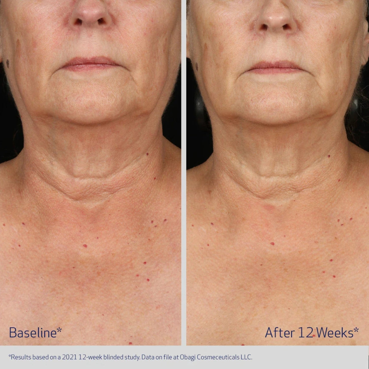 ObagiObagi ELASTIderm Neck and Decollete Concentrate 60mlSkinShop