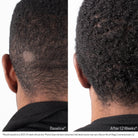 ObagiObagi Nu-Cil BioStim Scalp Serum 60mlSkinShop
