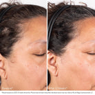 ObagiObagi Nu-Cil BioStim Scalp Serum 60mlSkinShop