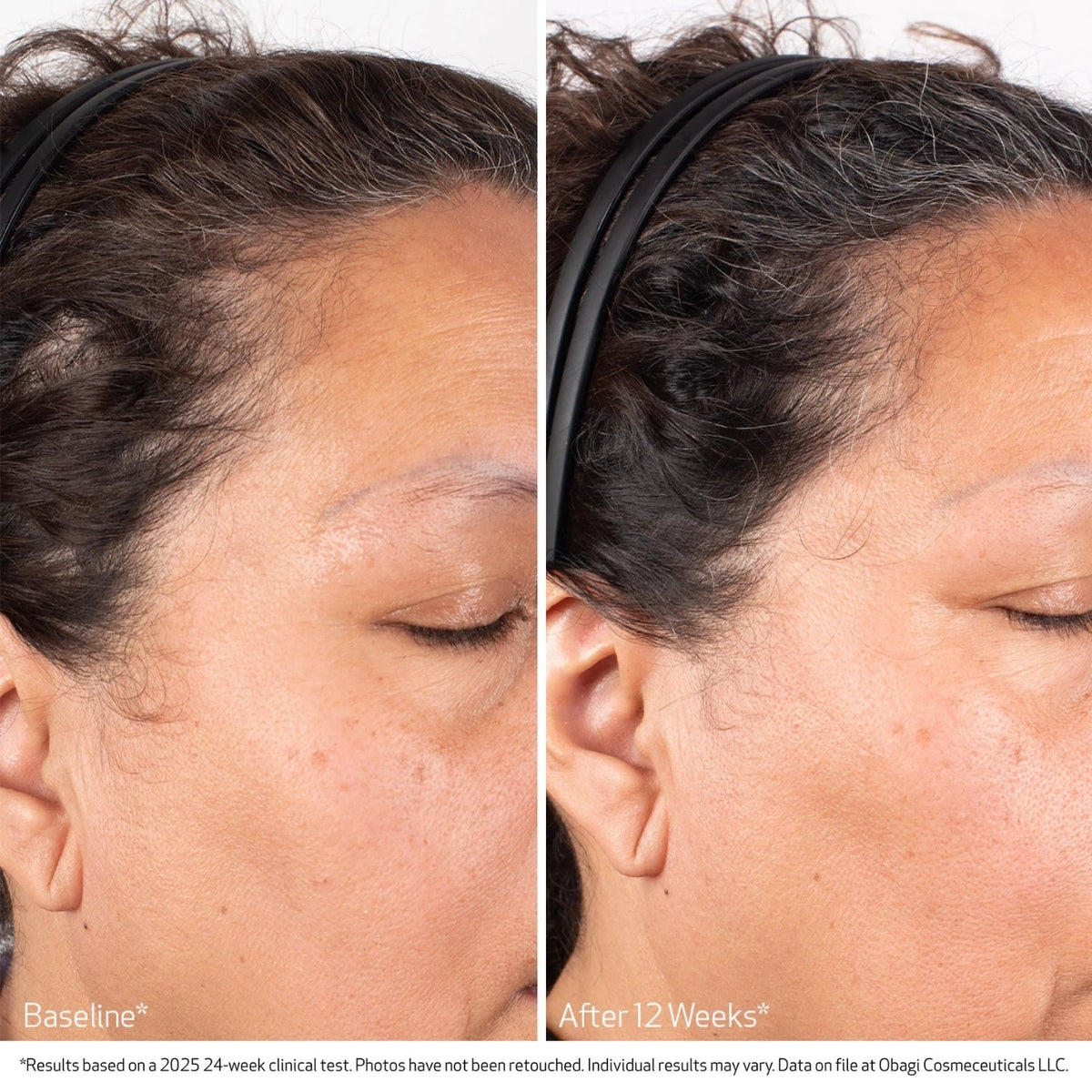 ObagiObagi Nu-Cil BioStim Scalp Serum 60mlSkinShop