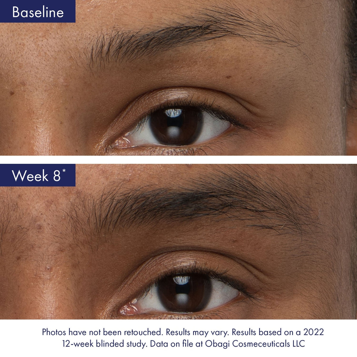 ObagiObagi Nu-Cil Eyebrow Boosting Serum 5mlSkinShop