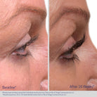 ObagiObagi Nu-Cil Eyelash Enhancing Serum 3mlSkinShop