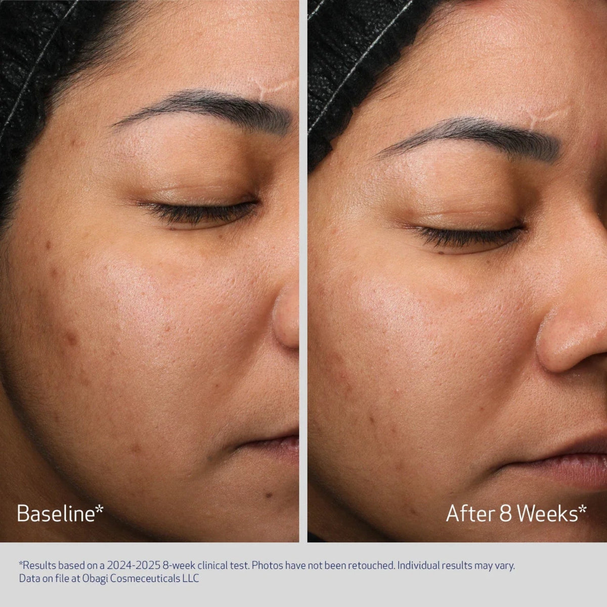 ObagiObagi Retinol + PHA Refining Night Cream 50mlSkinShop