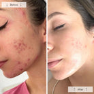OmniluxOmnilux Clear Face MaskSkinShop