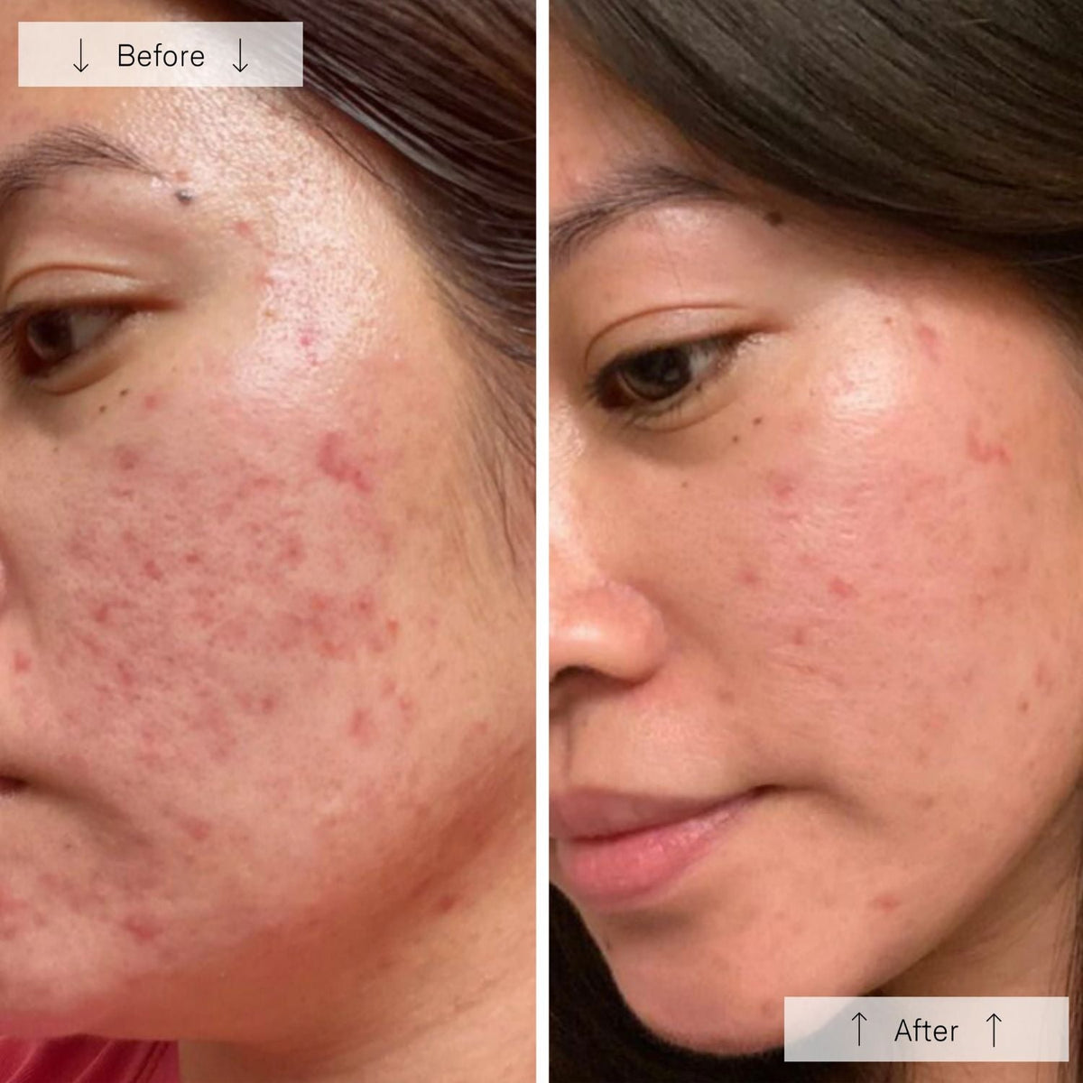 OmniluxOmnilux Clear Face MaskSkinShop