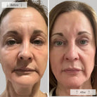 OmniluxOmnilux Contour Face MaskSkinShop