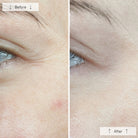 OmniluxOmnilux Contour Face MaskSkinShop