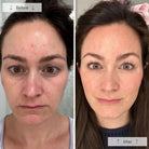 OmniluxOmnilux Contour Face MaskSkinShop