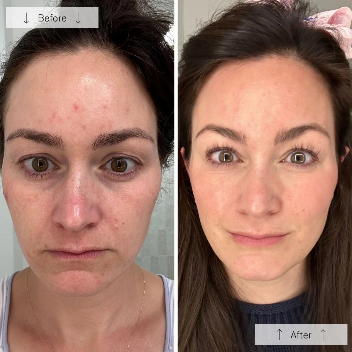 OmniluxOmnilux Contour Face MaskSkinShop